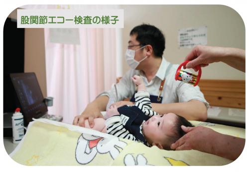 股関節脱臼検診の様子
